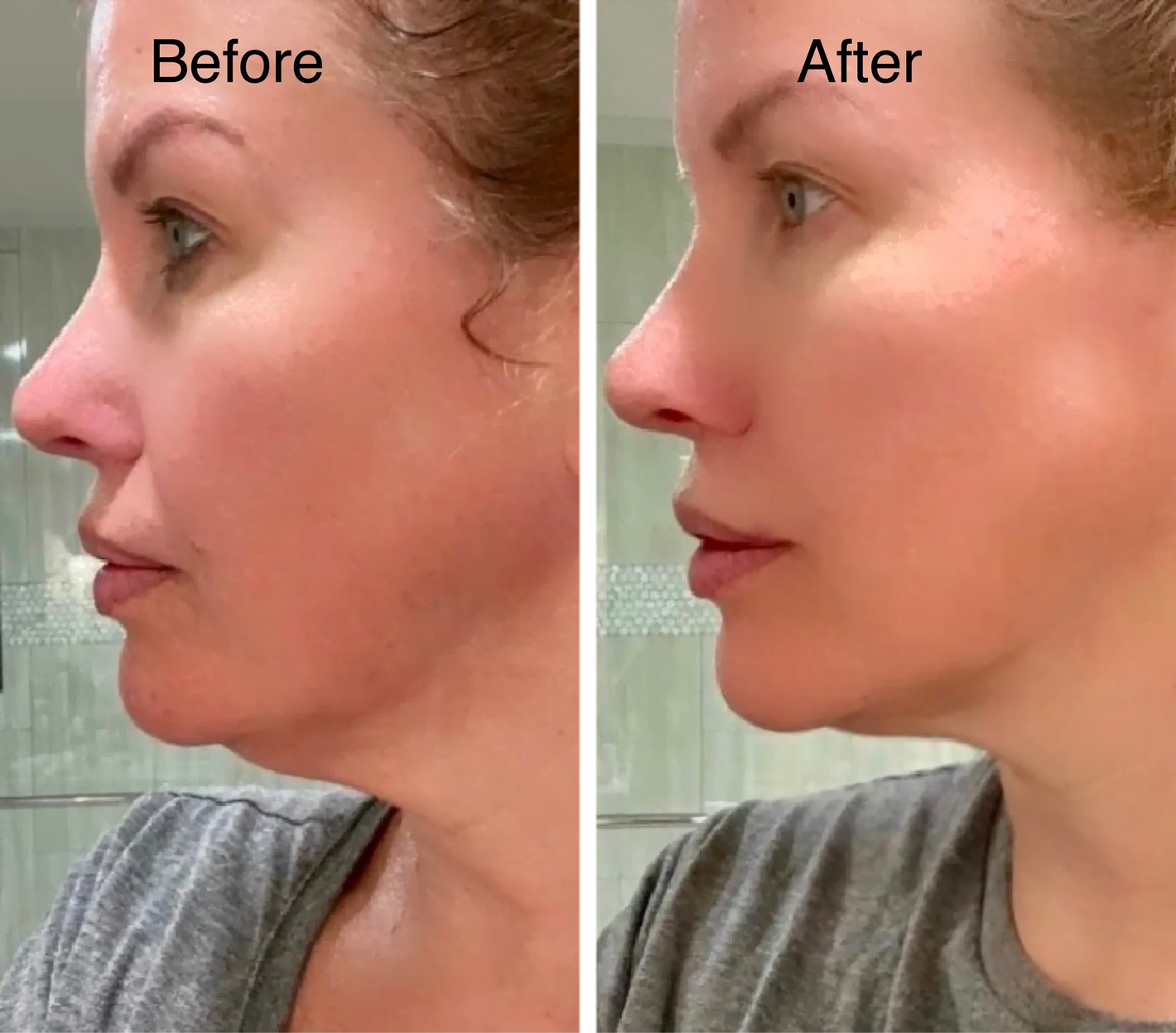 Korean CactoLift V-Band - Cooling & Pore Tightening™
