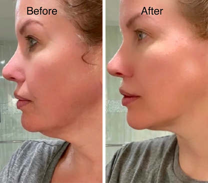 Korean CactoLift V-Band - Cooling & Pore Tightening™